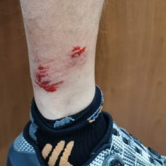 ADRANO, RANDAGISMO. CICLISTA MORSO DA BRANCO